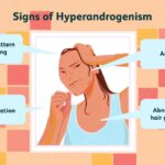 Testosterone in Women