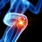 Joint health