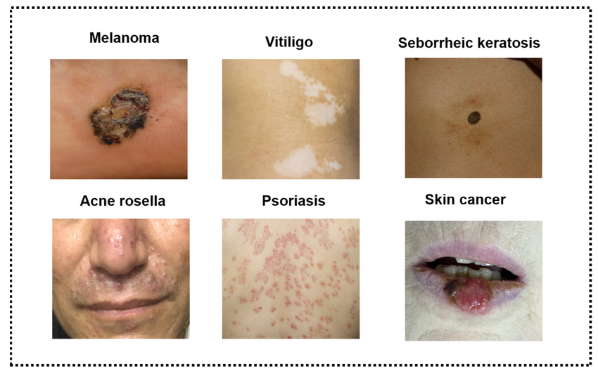 Common Skin Concerns