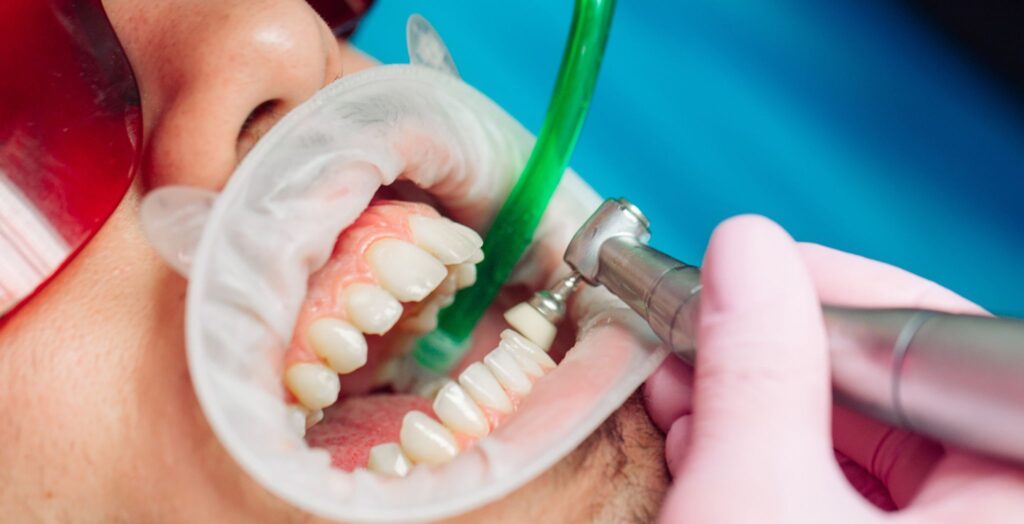 Dental Cleanings