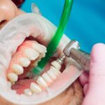Dental Cleanings