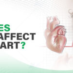 Does Stress Really Cause Heart Disease?
