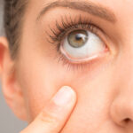 Benefits of Omega-3 Fatty Acids for Managing Dry Eye