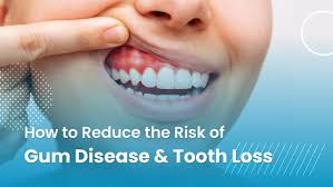 How to Reduce the Damage