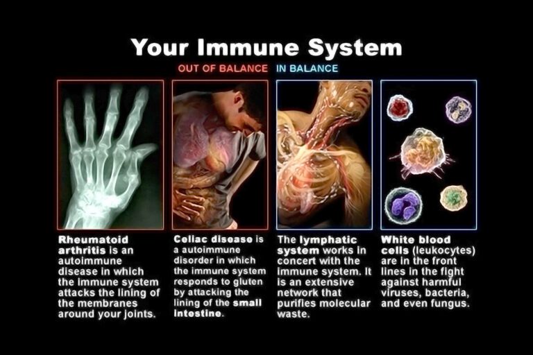 Immune System Conditions