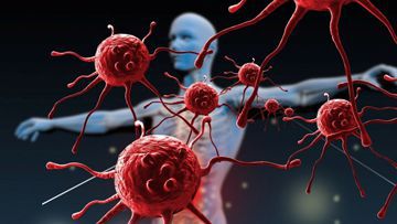  Immunodeficiency