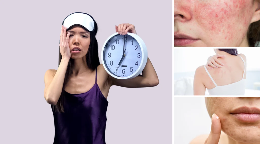 Sleep Affects Skin Health