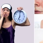 Sleep Affects Skin Health