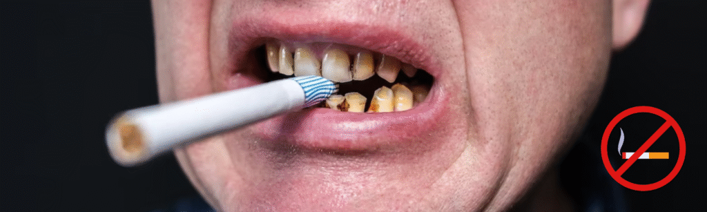 Impact of Lifestyle and Oral Hygiene on Cleaning Frequency