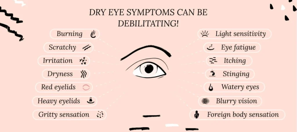 symptoms of Itchy Dry Eyes