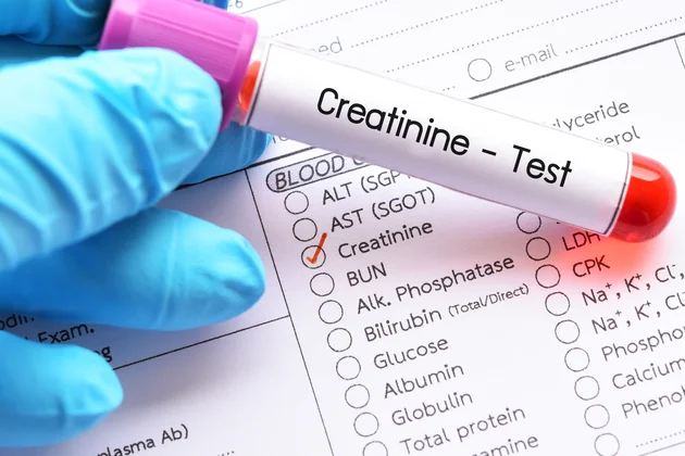 What is Creatinine
