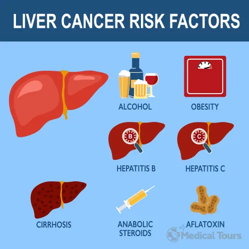 Key Risk Factors of Liver Cancer