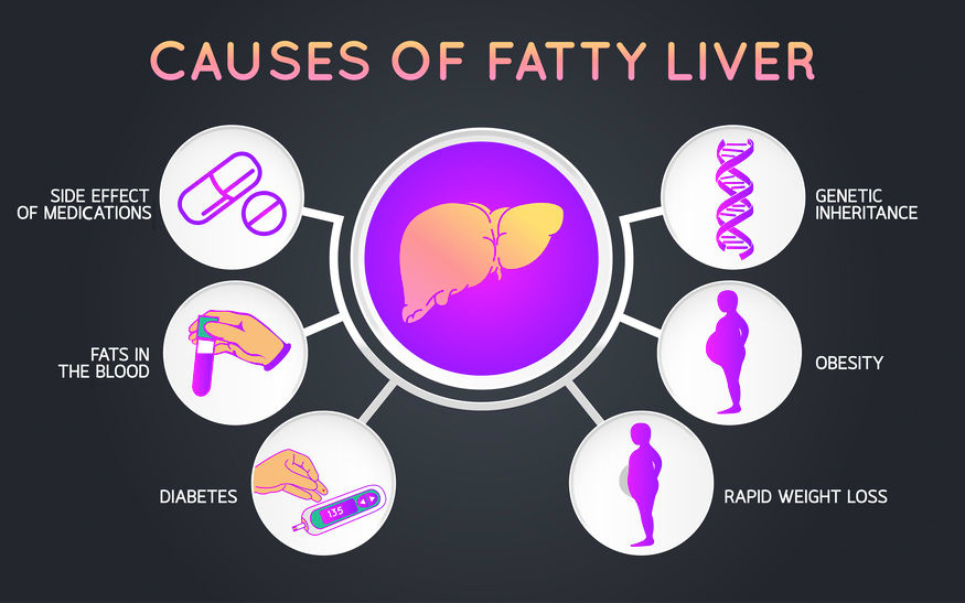 Non-Alcoholic Fatty Liver Disease
