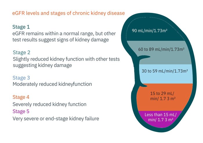 Staging Chronic Kidney Disease (CKD) Precisely