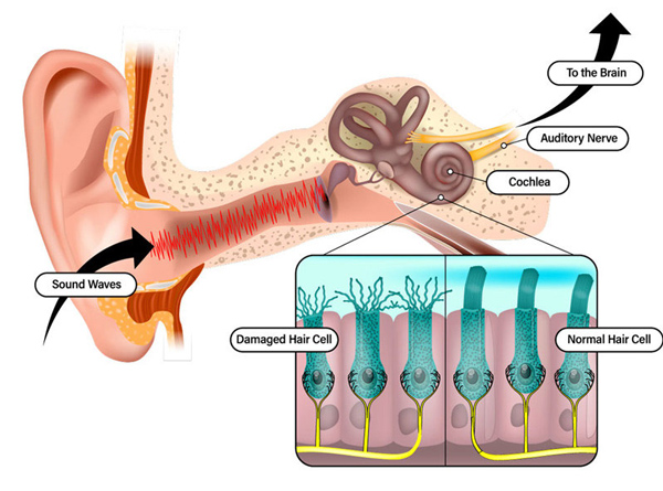 how loud noises affect hearing