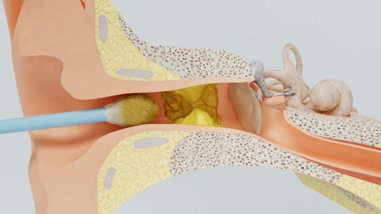 How to Clean Your Ears Safely